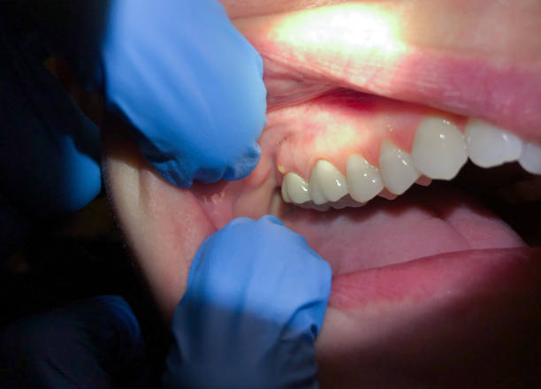 Best Knocked-Out Tooth Emergency  in West Haven, UT